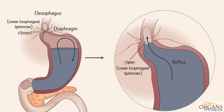 Esophageal Sphincter