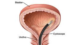 Bladder Function, Location And Pictures
