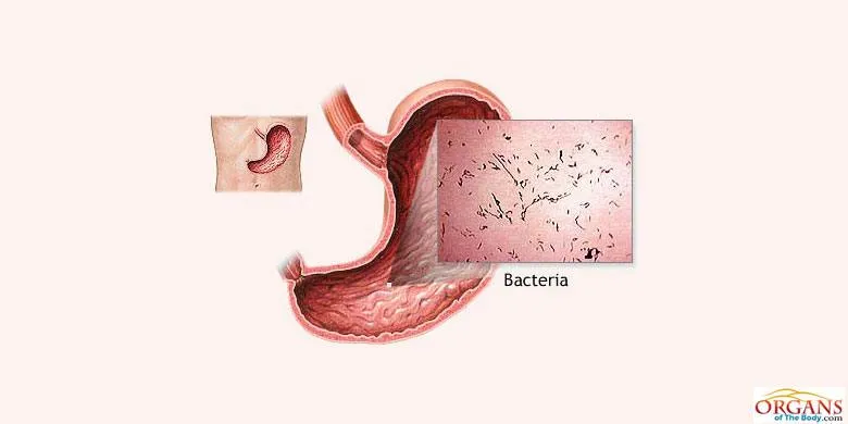 Stomach Bacteria