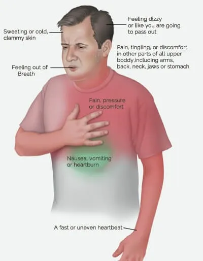 Atypical Symptoms of Heart Attack in Men