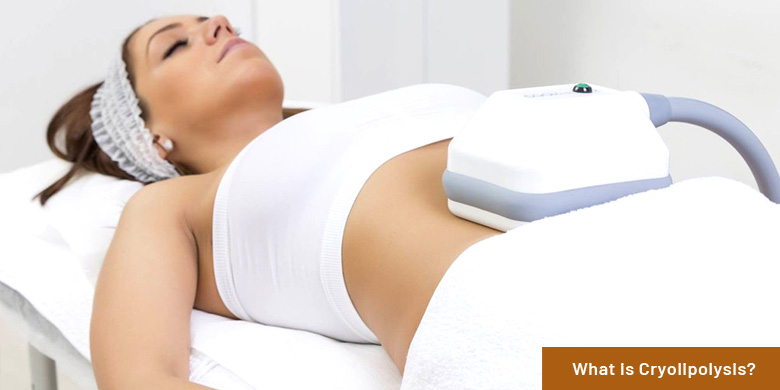 cryolipolysis