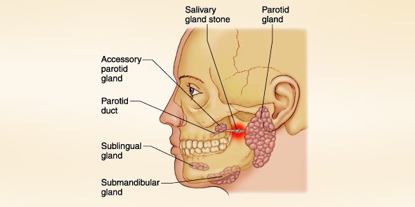 Salivary Glands Diseases