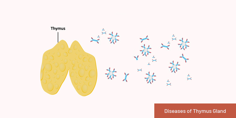 diseases of thymus gland
