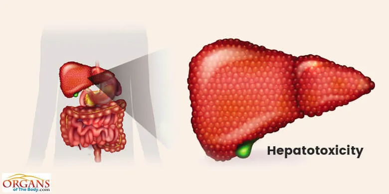 Types of Liver Diseases - Drug-induced Hepatotoxicity