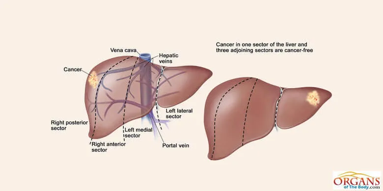 Types of Liver Diseases and Disorders