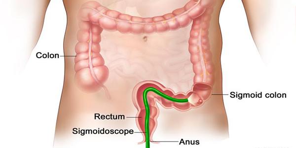 What is Rectum, Rectum Function with Parts