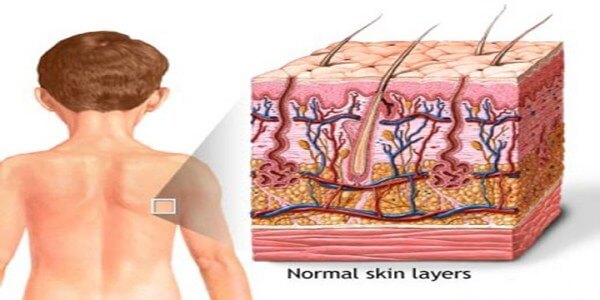 Skin