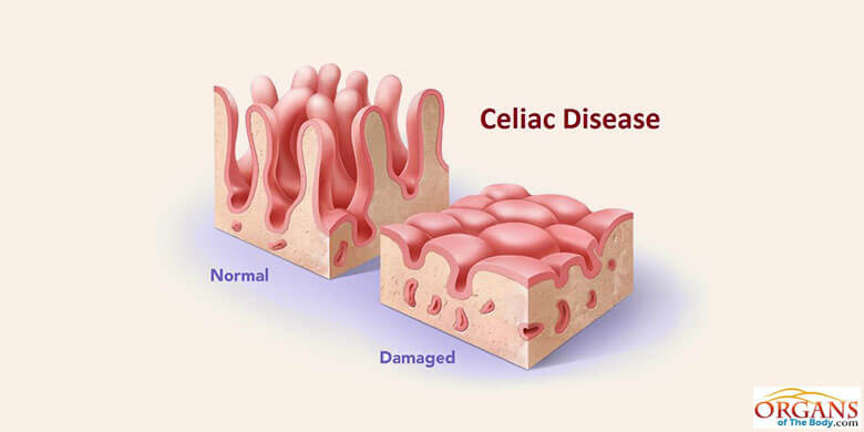 Small Intestine Diseases