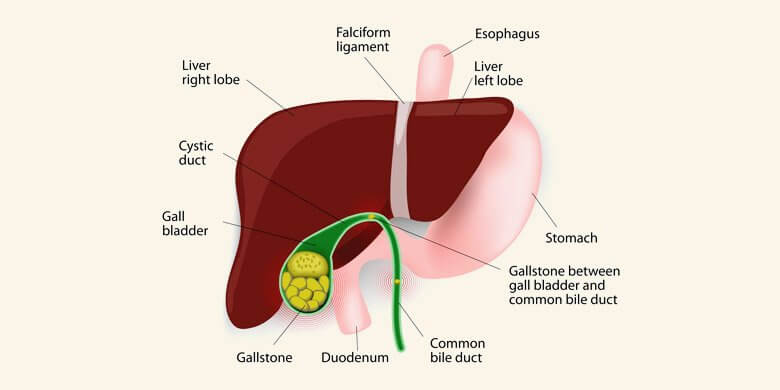 Symptoms of GallBladder Disease in Humans - Males and Females