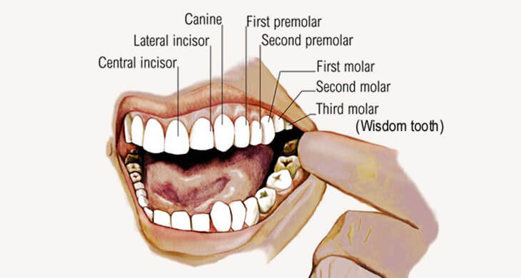 Wisdom Tooth